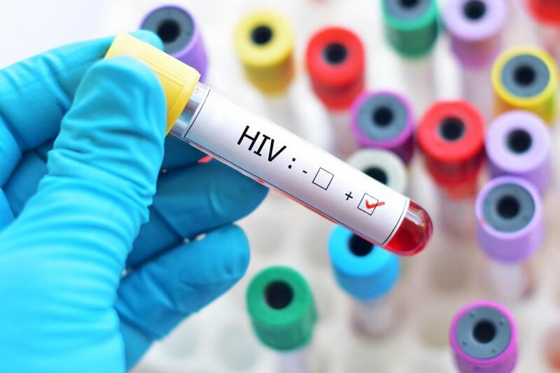 Bệnh HIV