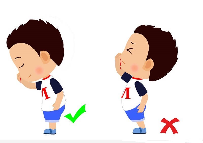 Phòng ngừa chuẩn là gì?