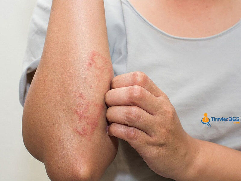 Mô tả công việc bác sĩ da liễu chi tiết nhất và đầy đủ nhất