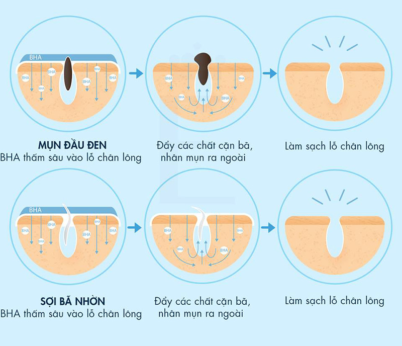 Bha là gì? Công dụng và cách dùng đúng chuẩn của BHA là gì?